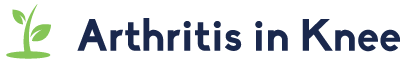 Arthritis in Knee